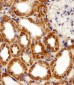 FBXL17 Isoform 2 Antibody (C-term)